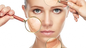 AÇIK TENLİYSENİZ CİLT LEKELERİNE 2 KAT DİKKAT! 