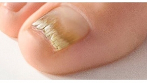 TIRNAKLARINIZ MANTARA ESİR OLMASIN