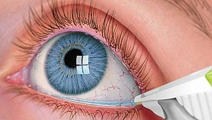 HER 2 KİŞİDEN BİRİ KURU GÖZ HASTALIĞIYLA KARŞI KARŞIYA 