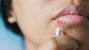 DUDAKTA UÇUK VE GÖĞÜS AĞRISI ZATÜRRE HABERCİSİ OLABİLİR 