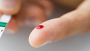 TÜRKİYE’NİN YÜZDE 39’U KAN ŞEKERİNİ ÖLÇTÜRMÜYOR 