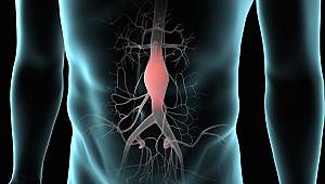 Karnınızdaki Saatli Bomba Aort Anevrizması 