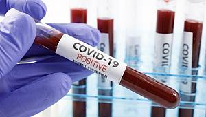 Koronavirüs Hakkında 10 Milyona Yakın Haber Çıktı