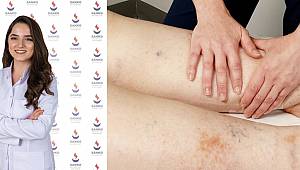 Lenfödem Tedavisinde En Yaygın ve Geçerli Yöntem, Kompleks Boşaltıcı Fizyoterapi Programıdır 